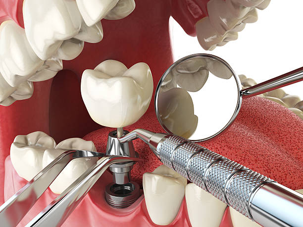 Best Emergency Denture Repair in Lansing, IL